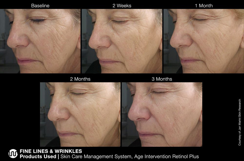 Marini SkinSolutions Retinol Plus Przeciwstarzeniowy krem z retinolem 28 g