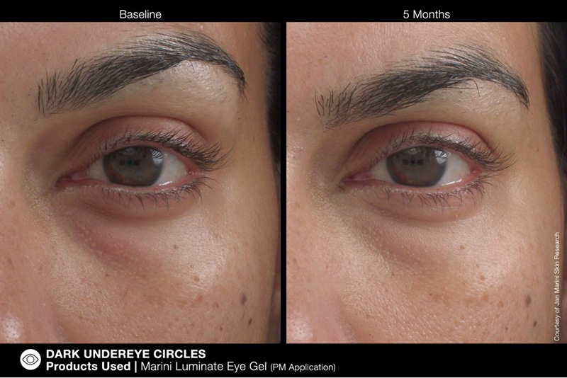 Marini SkinSolutions Marini Luminate Eye Gel Żel rozjaśniający do pielęgnacji okolic oczu 15 ml