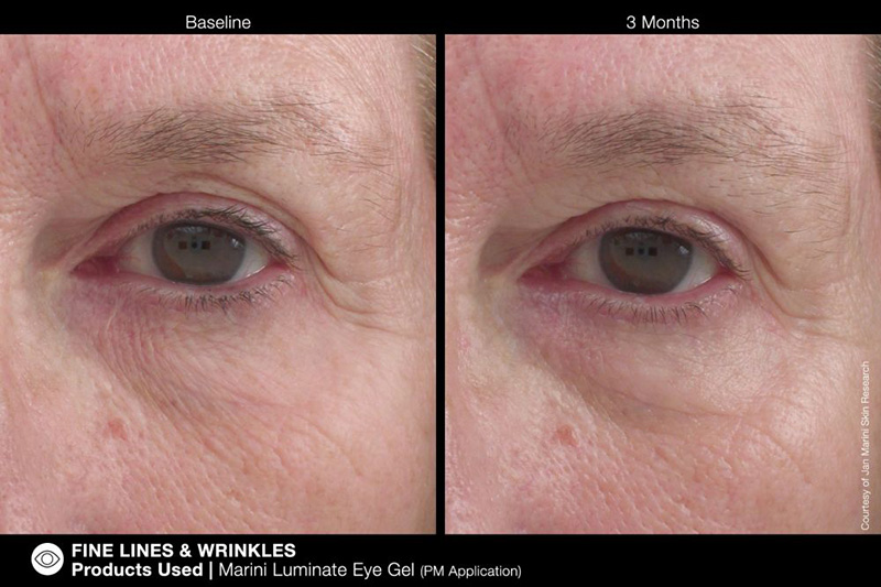 Marini SkinSolutions Marini Luminate Eye Gel Żel rozjaśniający do pielęgnacji okolic oczu 15 ml